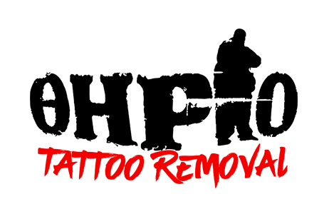 Erased Laser Tattoo Removal - From $211.50 - Las Vegas, NV | Groupon